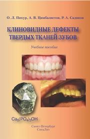Клиновидные дефекты твёрдых тканей Пихур О.Л., Цимбалистов А.В., Садиков Р.А.